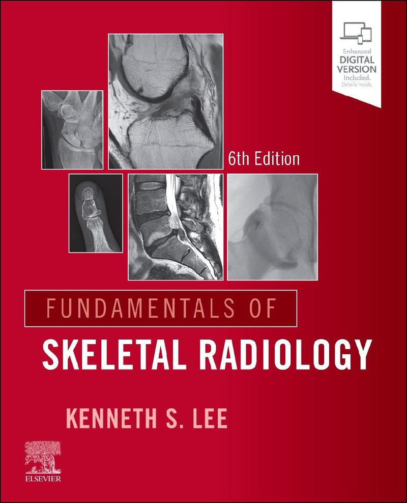 Fundamentals of Skeletal Radiology – Kenneth S Lee | Taschenbuch – Averdo