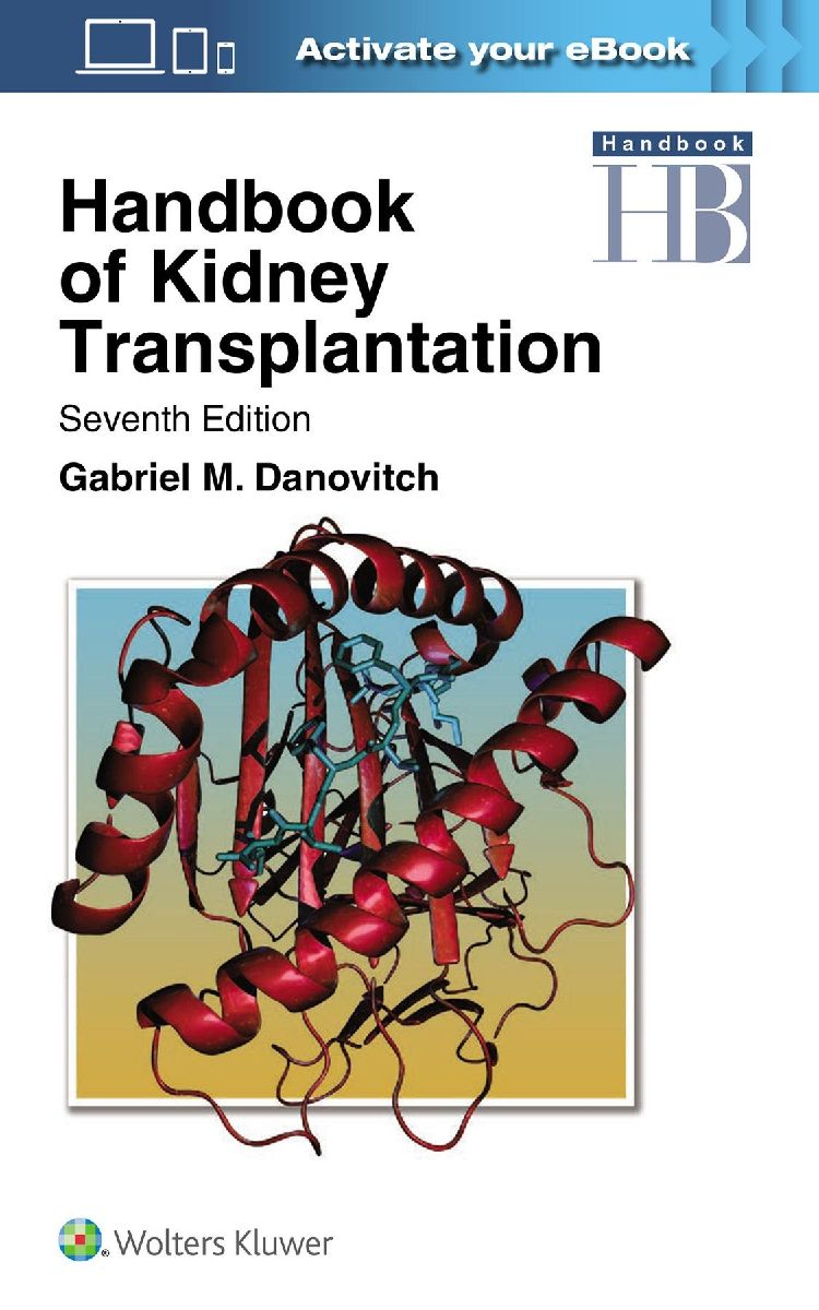 Handbook of Kidney Transplantation