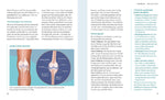 Schmerzfrei bei Arthrose