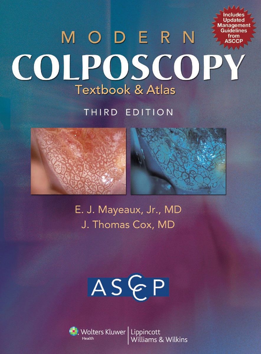 Modern Colposcopy Textbook and Atlas | Gebunden – Averdo