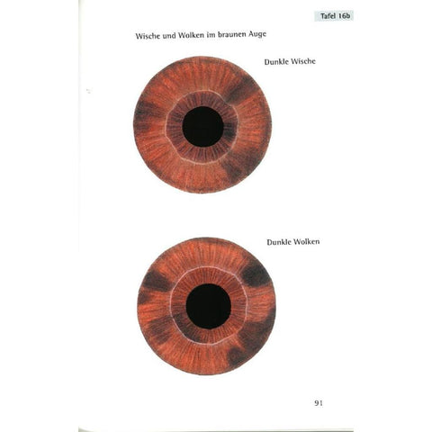 Repertorium der Irisdiagnose