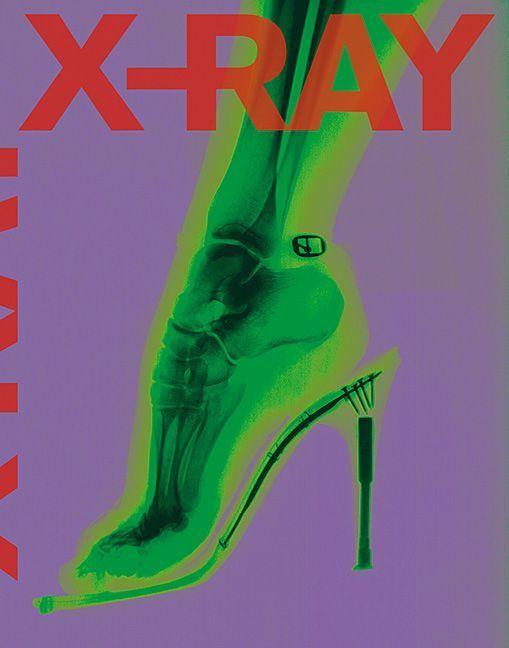 X-RAY