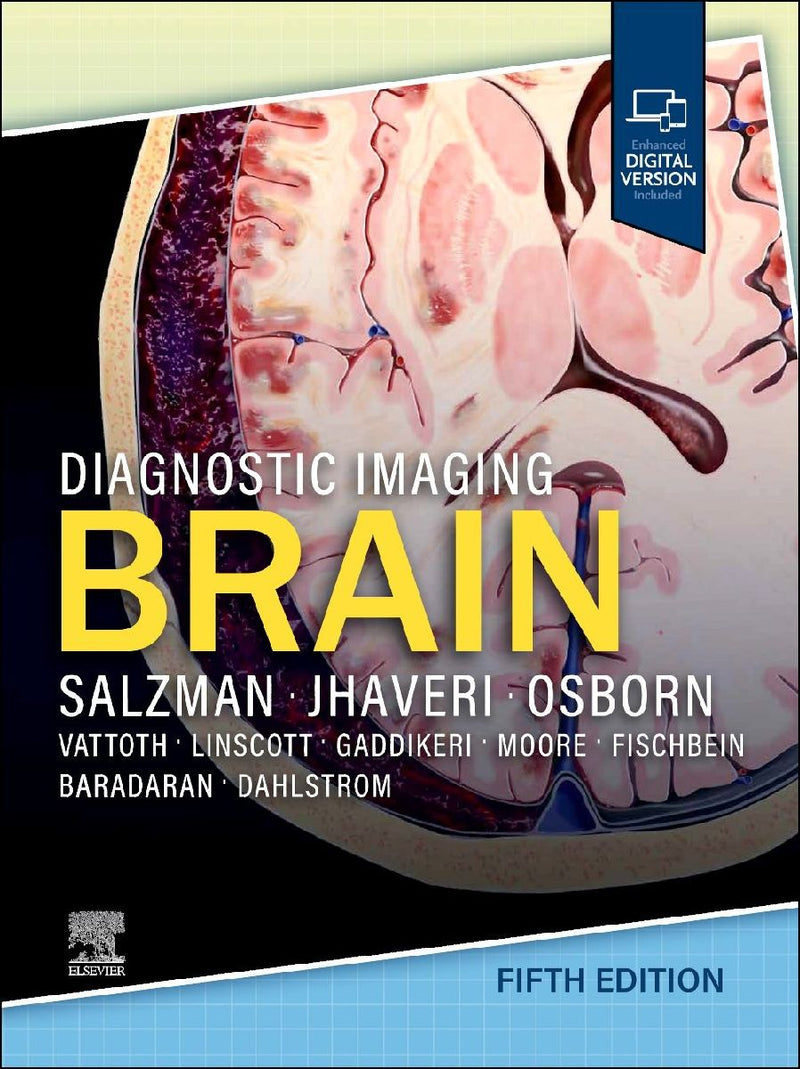 Diagnostic Imaging: Brain,